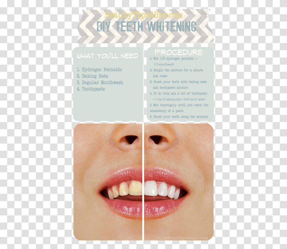 Ways To Make Ur Teeth Straight, Mouth, Lip, Person, Human Transparent Png