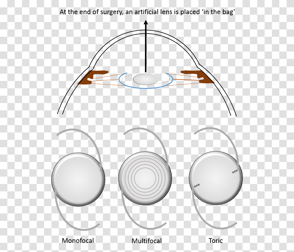 What Are Intraocular Lens, Cooktop, Indoors, Electronics Transparent Png