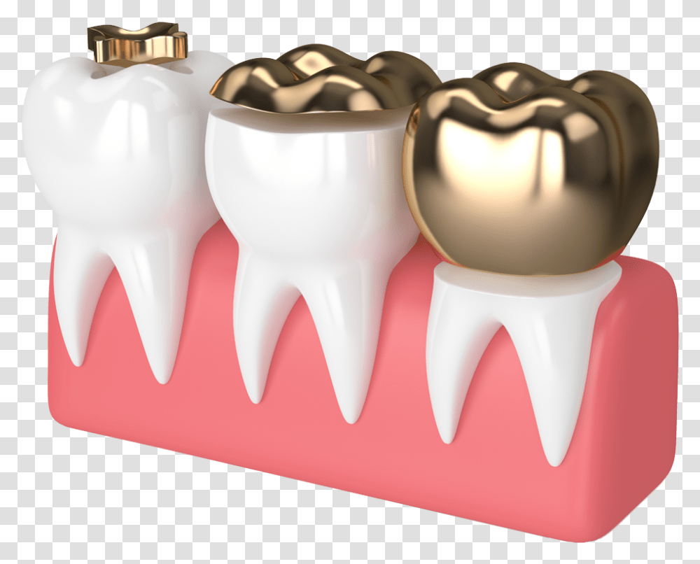 White Fillings Crown, Furniture, Birthday Cake, Dessert, Food Transparent Png