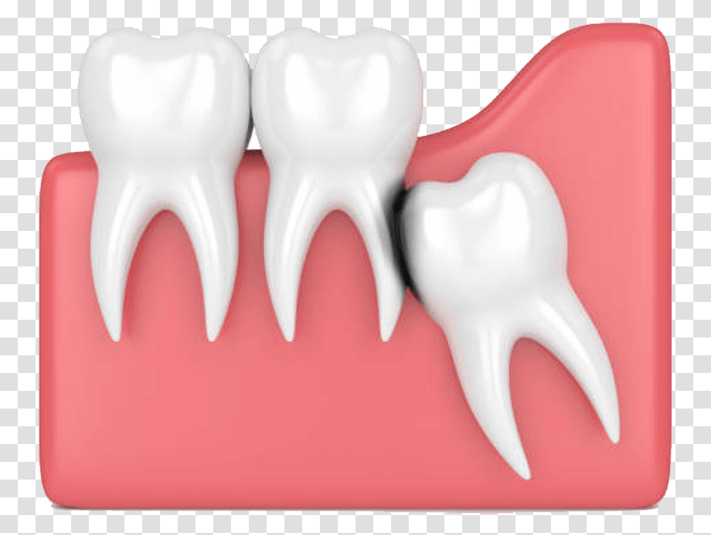 Wisdom Teeth, Mouth, Lip, Jaw, Sweets Transparent Png