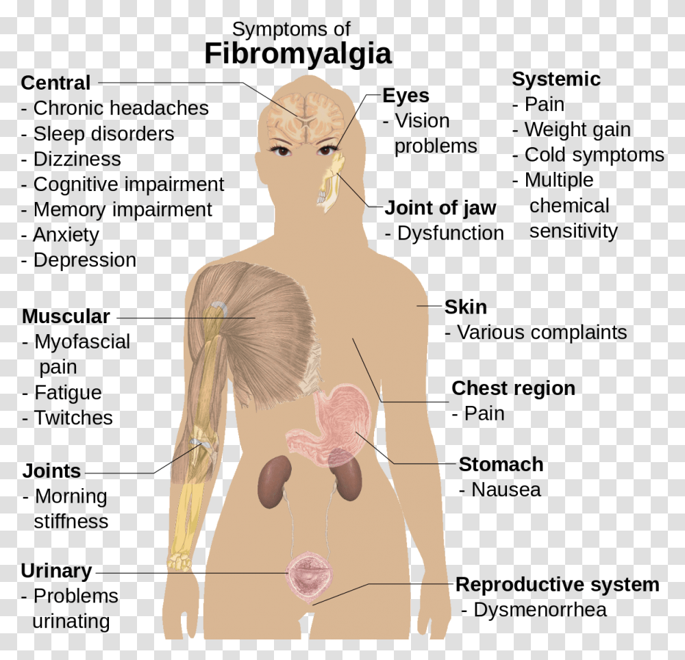 Woman Fibromyalgia Trigger Points, Torso, Person, Plot Transparent Png