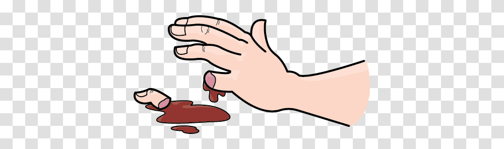 Wound Clipart Bleeding Kansas, Hand, Wrist, Bowl, Skin Transparent Png