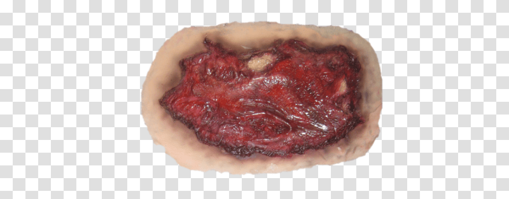 Wound, Person, Food, Gemstone, Jewelry Transparent Png