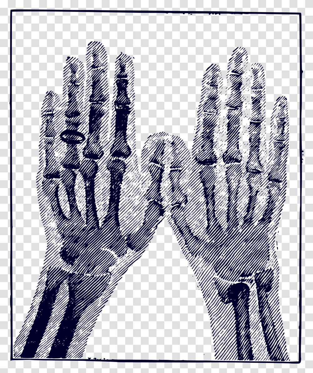 X Ray Image Clip Arts Clipart X Ray, Hand, Fist Transparent Png