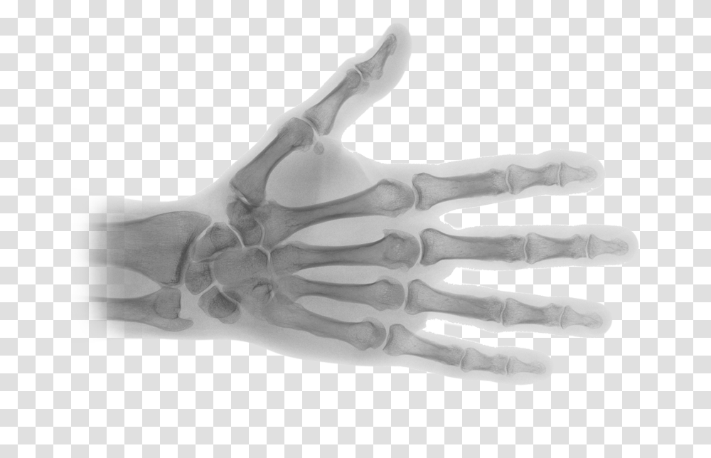 X Ray Image, X-Ray, Ct Scan, Medical Imaging X-Ray Film, Skeleton Transparent Png