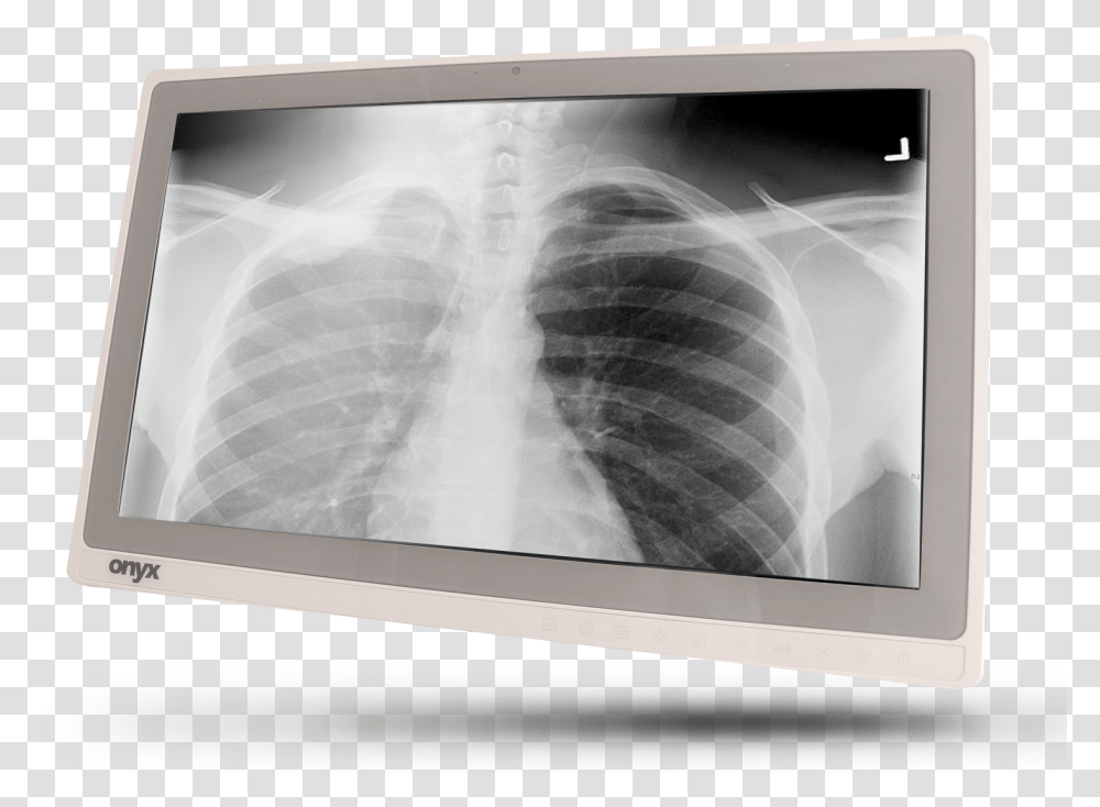 X Ray, Monitor, Screen, Electronics, Display Transparent Png