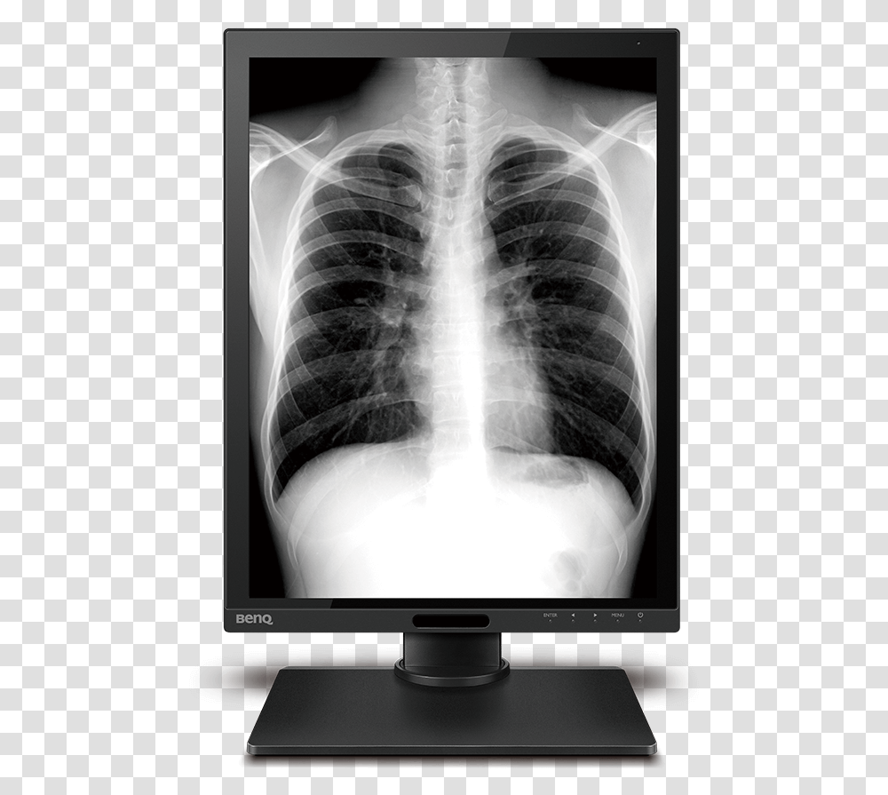 X Ray, Monitor, Screen, Electronics, Display Transparent Png