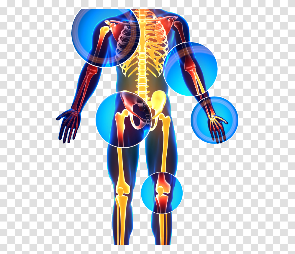 X Ray, Purple, Hip, Shoulder, X-Ray Transparent Png