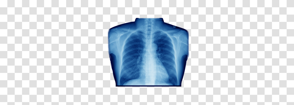 Xray, Electronics, Diaper, X-Ray, Medical Imaging X-Ray Film Transparent Png