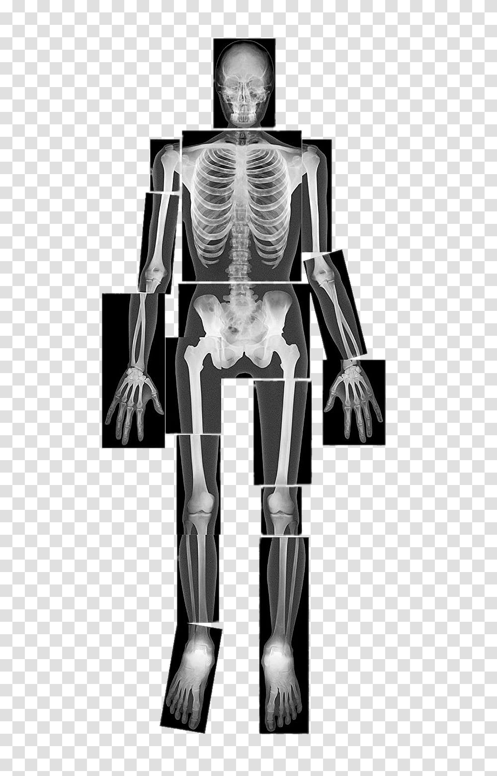 Xray, Electronics, X-Ray, Ct Scan, Medical Imaging X-Ray Film Transparent Png