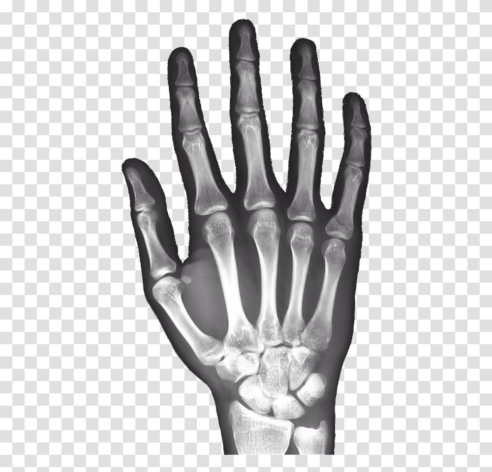 Xray, Electronics, X-Ray, Medical Imaging X-Ray Film, Ct Scan Transparent Png
